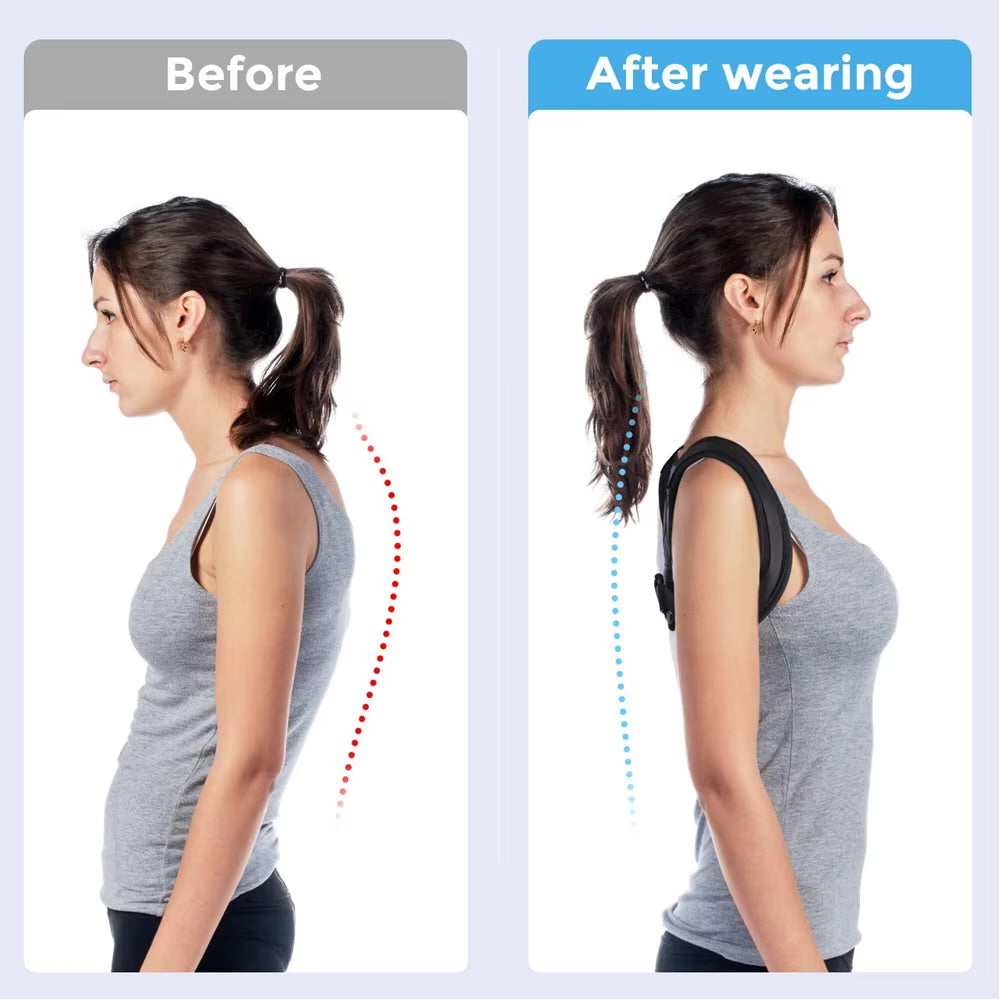 Posture corrector